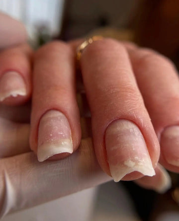 Pourquoi mes ongles se cassent ? Causes et solutions efficaces pour des ongles plus forts The FrenchTouch